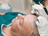 Your Guide to Hair Transplant Surgery in Turkey 2
