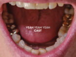 ALBUM REVIEW: Cast - Yeah Yeah Yeah