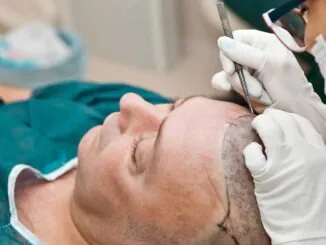 Your Guide to Hair Transplant Surgery in Turkey 2
